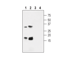 Anti-KCNE4 (MiRP3) Antibody