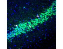 Anti-KChIP2 Antibody