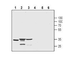 Anti-KChIP3 (CSEN, DREAM) Antibody