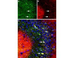 Anti-DPP6 (extracellular) Antibody