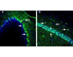 Anti-DPP10 (extracellular) Antibody