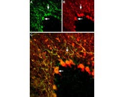 Anti-K<sub>V</sub>1.5 (KCNA5) (extracellular) Antibody