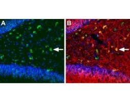 Anti-KCNQ5 Antibody