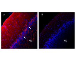 Anti-K<sub>V</sub>1.1 (KCNA1) (extracellular) Antibody