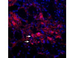 Anti-KCNQ4 Antibody