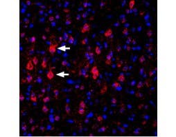 Anti-K<sub>V</sub>1.4 (extracellular) Antibody
