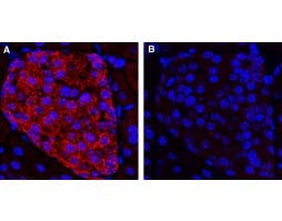 Anti-KCNK16 (TALK-1) (extracellular) Antibody