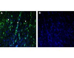 Anti-TMEM175 Antibody