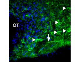Anti-P2X1 Receptor Antibody