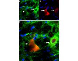 Anti-P2X4 Receptor Antibody