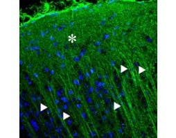 Anti-P2X2 Receptor Antibody