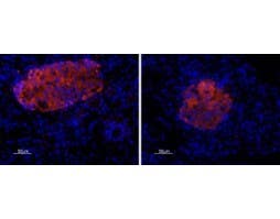 Anti-P2X7 Receptor Antibody
