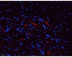 Anti-P2X5 Receptor Antibody