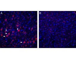 Anti-P2Y6 Receptor Antibody