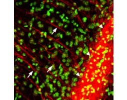 Anti-P2Y12 Receptor Antibody