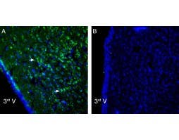 Anti-P2X6 Receptor Antibody