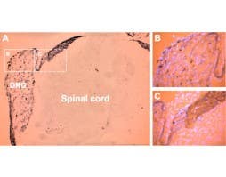 Anti-P2X3 Receptor Antibody