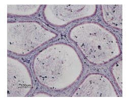 Anti-P2Y13 Receptor Antibody