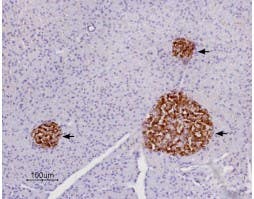 Anti-P2Y14 Receptor (extracellular) Antibody
