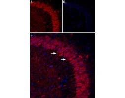 Anti-P2Y1 Receptor (extracellular) Antibody