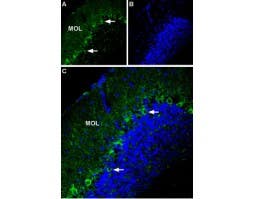 Anti-P2X1 Receptor (extracellular) Antibody