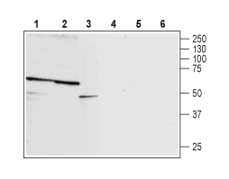 Anti-P2X2 Receptor (extracellular) Antibody