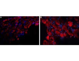 Anti-P2X3 Receptor (extracellular) Antibody