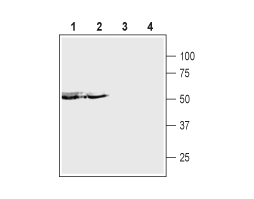 Anti-P2X5 Receptor (extracellular) Antibody