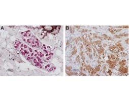 Anti-Human PAR1 (F2R) (extracellular) Antibody