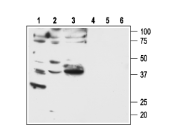 Anti-PAR2 (F2RL1) Antibody