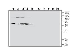Anti-Human PAR2/F2RL1 (extracellular) Antibody