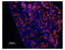 Anti-Prokineticin Receptor 1 (extracellular) Antibody