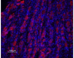Anti-Prokineticin Receptor 2 (extracellular) Antibody