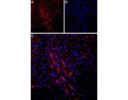 Anti-PTH1R (extracellular) Antibody