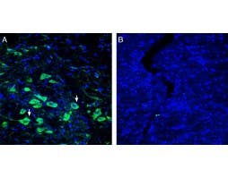 Anti-Platelet-activating factor receptor (extracellular) Antibody