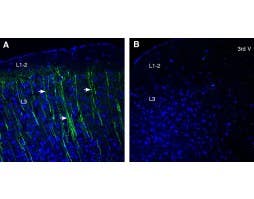 Anti-Prostaglandin E Receptor EP3 (PTGER3) Antibody