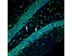 Anti-Prostaglandin F2-α Receptor/PTGFR Antibody