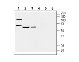 Anti-Prostacyclin Receptor (PTGIR) (extracellular) Antibody