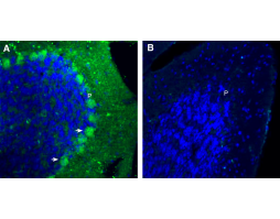 Anti-Plexin-B1 (extracellular) Antibody