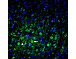 Anti-Plexin-A3 (extracellular) Antibody