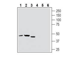Anti-Thromboxane A2 Receptor (extracellular) Antibody
