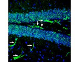 Anti-P2Y2 Receptor (extracellular) Antibody