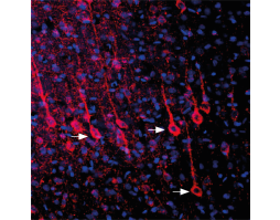 Anti-P2Y6 Receptor (extracellular) Antibody