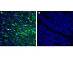 Anti-P2Y10 (extracellular) Antibody