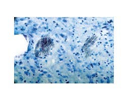 Anti-P2Y1 Receptor Antibody