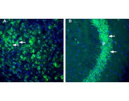 Anti-Thromboxane A2 Receptor Antibody