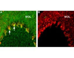 Anti-Caspr2 Antibody