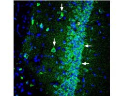 Anti-Shank1 Antibody