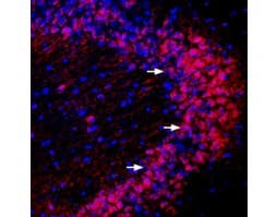 Anti-PICK1 Antibody