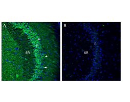 Anti-Cortactin Antibody